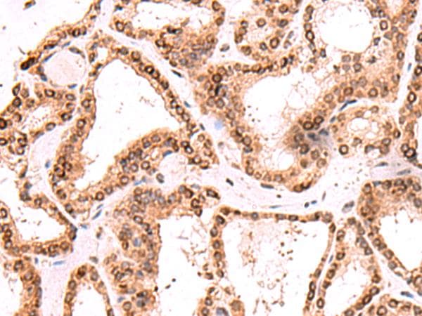 Polyclonal Rabbit anti-Human TOR1AIP1 / LAP1 Antibody (IHC)