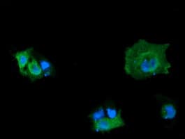 MAP2K3 / MEK3 / MKK3 Antibody (clone OTI5E2)