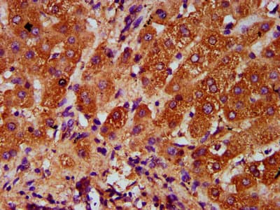 AASS / LKR / SDH Antibody