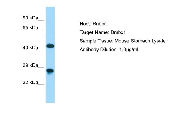 DMBX1 / OTX3 Antibody (C-Terminus)