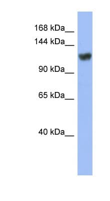 Polyclonal Rabbit anti-Human ZNF423 / OAZ Antibody (C-Terminus, WB)
