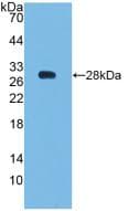 BCL2 / Bcl-2 Antibody (aa2-211)
