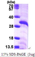 Human FBL / FIB / Fibrillarin Protein (Recombinant His)