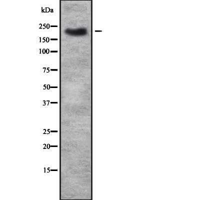 TRPM7 Antibody