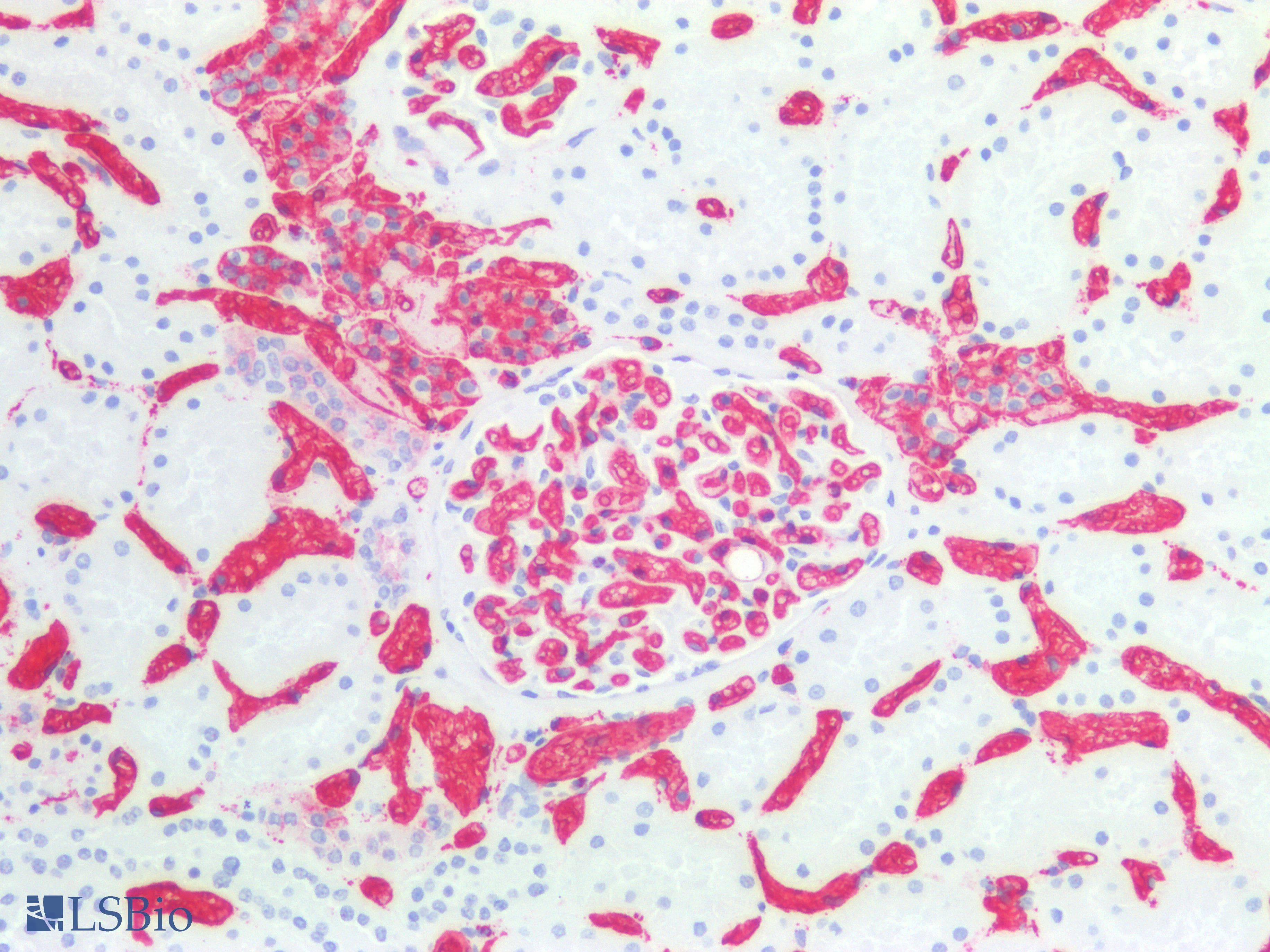 IHC-plus™ Blood Group A Antibody (clone HE-193, Supernatant)