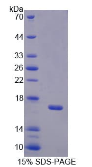 Mouse BPI Protein (Recombinant His-T7)