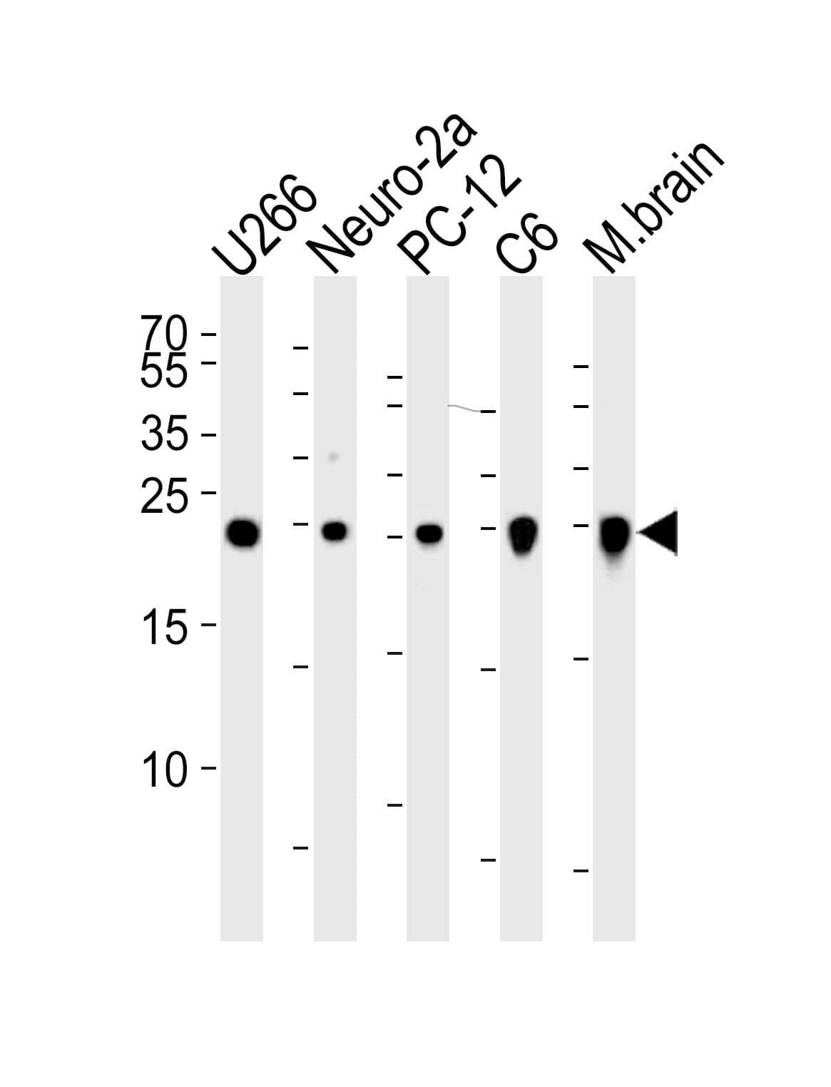 UCHL1 / PGP9.5 Antibody