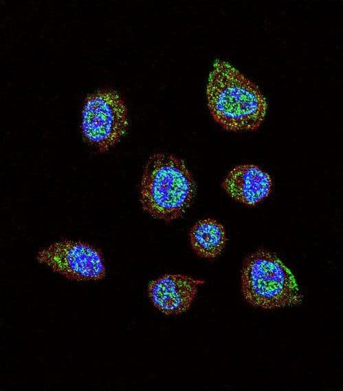Polyclonal Rabbit anti-Human HIF1A / HIF1 Alpha Antibody (aa728-757, IHC, IF, WB)