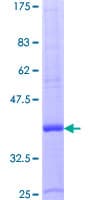 Human CCL15 / MIP5 Protein (Recombinant GST)