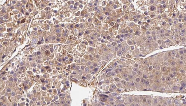 Polyclonal Rabbit anti-Human OR2B6 Antibody (IHC, WB)