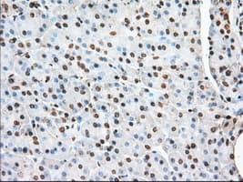 ACAT2 Antibody (clone OTI5F7)