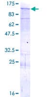 Human SIK1 / MSK Protein (Recombinant GST)