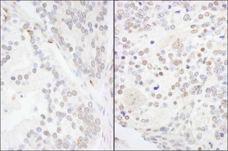 ANKS3 Antibody (aa606-656)