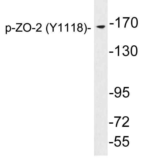 TJP2 / ZO2 / ZO-2 Antibody (phospho-Tyr1118)