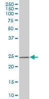 DCUN1D1 / SCCRO Antibody (clone 4B5)