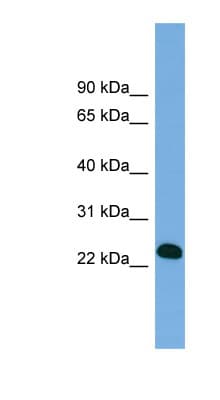 BCL7A Antibody (aa71-120)