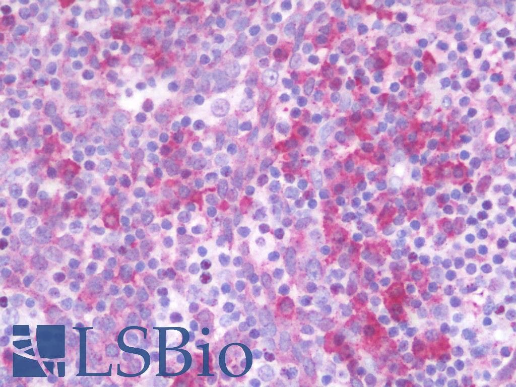 IHC-plus™ Polyclonal Rabbit anti-Human RAB11FIP4 / RAB11-FIP4 Antibody (aa452-501, IHC, WB)