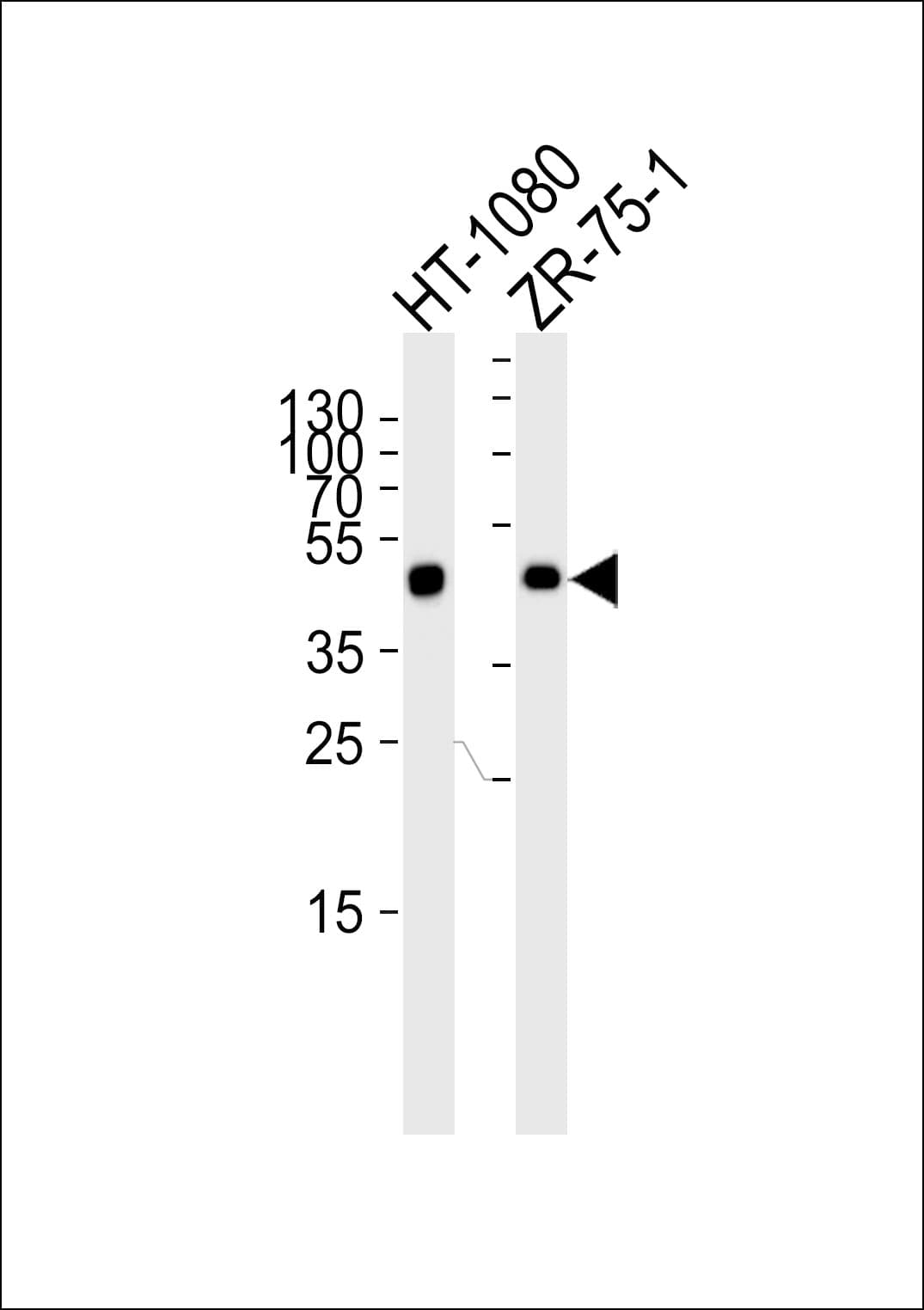 CRTAP Antibody (aa31-59)