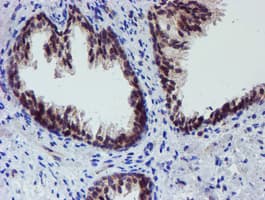 ALOX15 / 15-Lipoxygenase Antibody (clone OTI2G3)