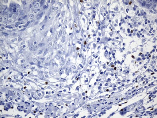 FOXP3 Antibody (clone UMAB248, Carrier-free)