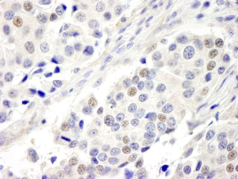 C17orf71 Antibody (aa250-300)