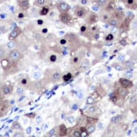 IHC-plus™ TOP2A / Topoisomerase II Alpha Antibody (N-Terminus)