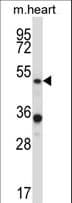 Polyclonal Rabbit anti-Human PIAS4 / PIASY Antibody (aa44-73, WB)