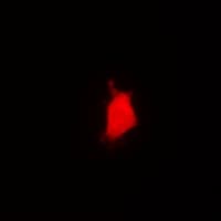 PARN Antibody