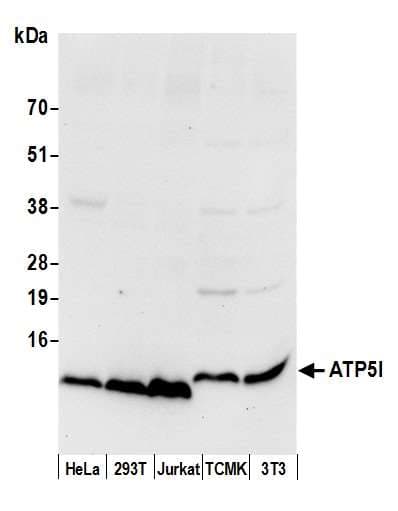 Polyclonal Rabbit anti-Human ATP5I Antibody (aa19-69, WB)