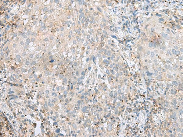 Polyclonal Rabbit anti-Human SEPT1 / Septin 1 Antibody (IHC)