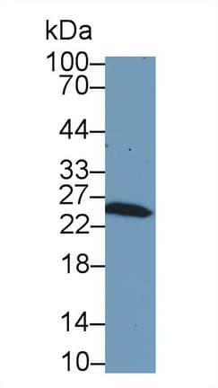 GSTM1 Antibody (aa1-218)