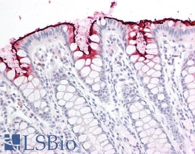 CD66acd Antibody (clone YTH71.3)