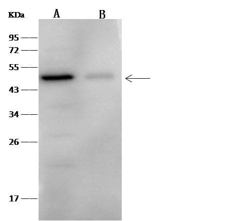 FOXA1 Antibody (Preservative Free)