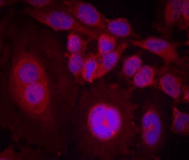 STAT3 Antibody