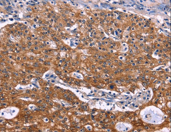 NOS2 / iNOS Antibody