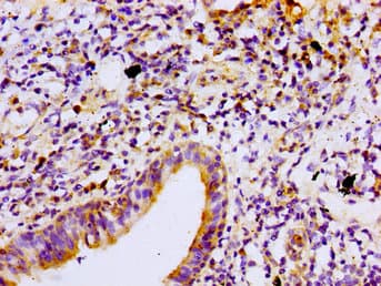 PRKCB / PKC-Beta Antibody