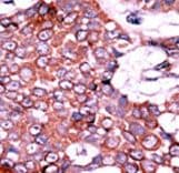 CDC25A Antibody (phospho-Ser75)