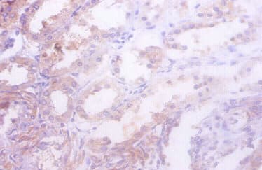 IDH1 / IDH Antibody