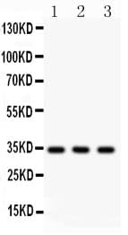 CASP7 / Caspase 7 Antibody (aa117-198)