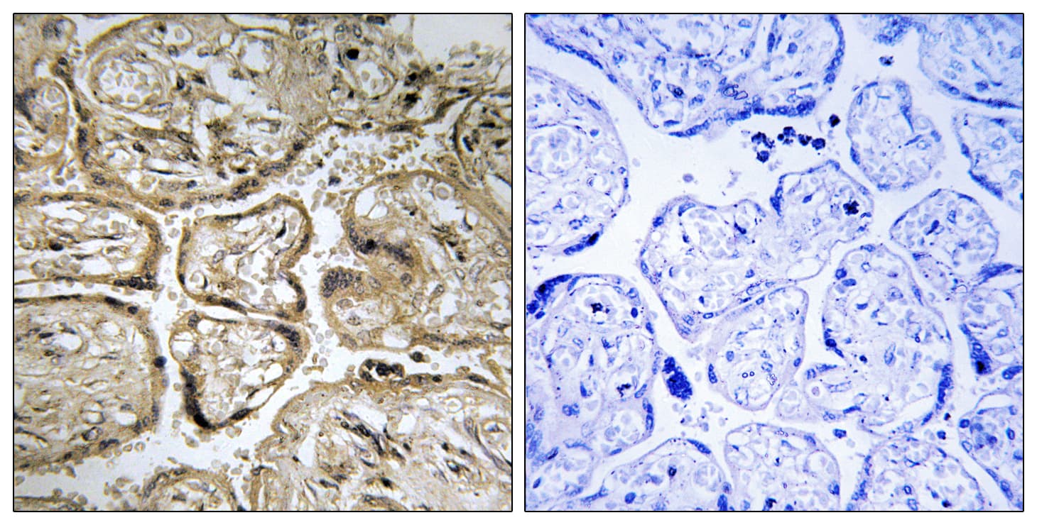 Polyclonal Rabbit anti-Human CST9L / Cystatin 9-Like Antibody (aa81-130, IHC)
