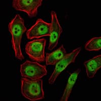 KDM4A / JHDM3A / JMJD2A Antibody (clone 5H1)