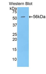 PLS3 / T Plastin Antibody (aa379-630)
