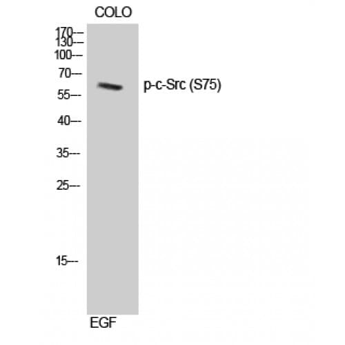 SRC Antibody (10-90 aa)