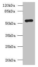 Polyclonal Rabbit anti-Human SLC38A2 / SNAT2 Antibody (aa1-76, IHC, WB)
