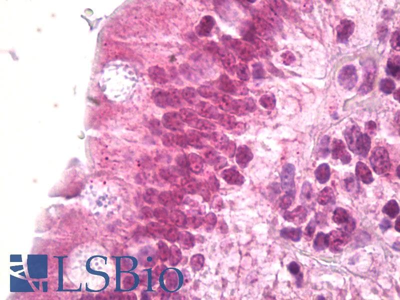 IHC-plus™ DAXX Antibody (aa634-683)