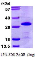 Human SNRPB2 Protein (Recombinant His)