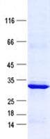 Human FAM86B1 Protein (Recombinant His, N-Terminal)