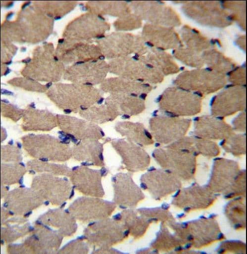 MGAT4C Antibody (aa303-332)