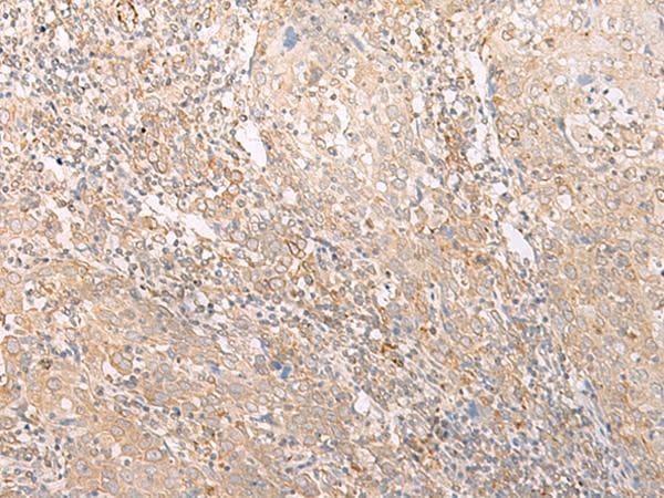 EPS15 Antibody