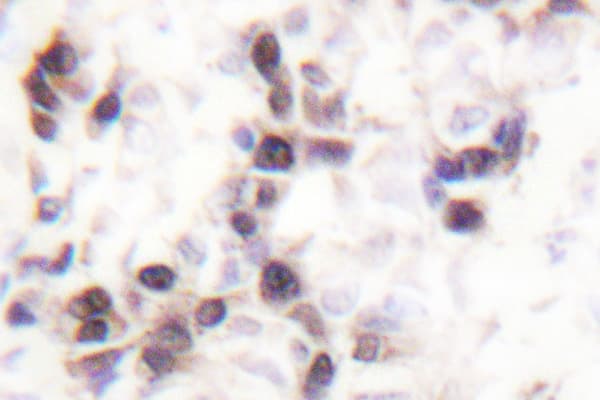 HNRNPC / HNRNP C Antibody (Gly256)